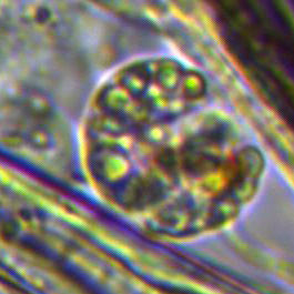 E'' a pois e piuttosto nevrotico